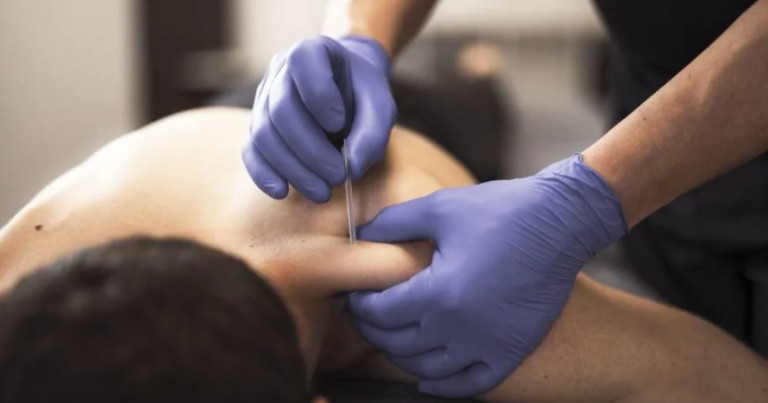puncion-seca-una-tecnica-eficaz-para-el-dolor-muscular